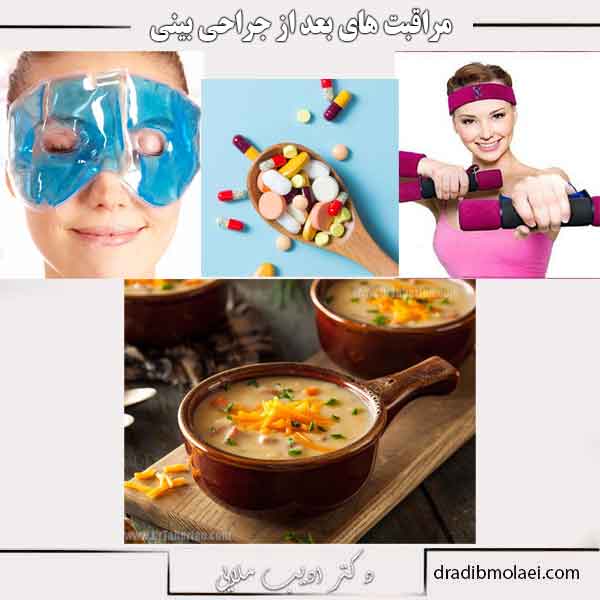 مراقبت های بعد از جراحی بینی
