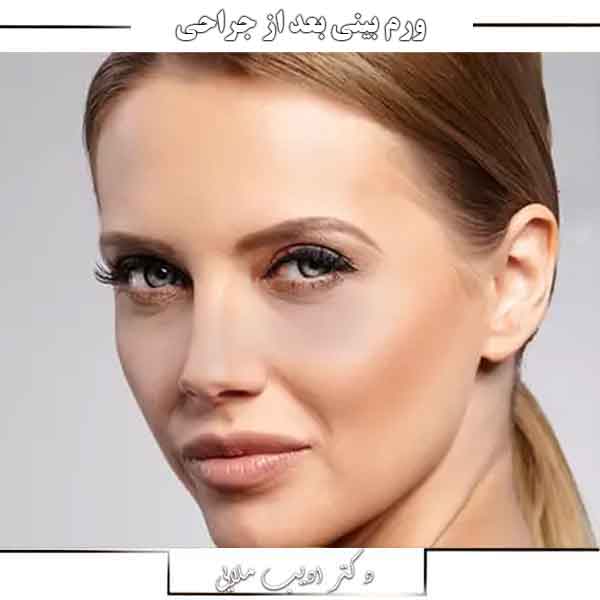 ورم بینی بعد از جراحی