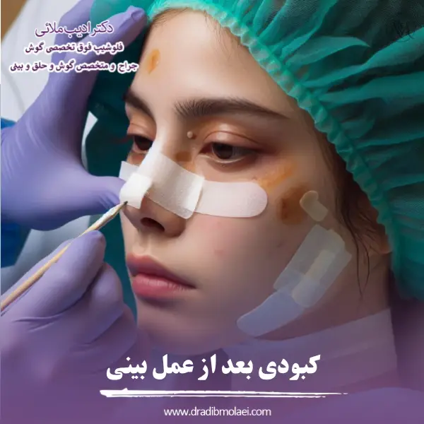 کبودی بعد از جراحی بینی _ دکتر ادیب ملائی