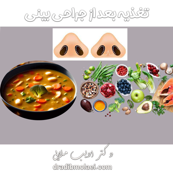 تغذیه بعد از جراحی بینی