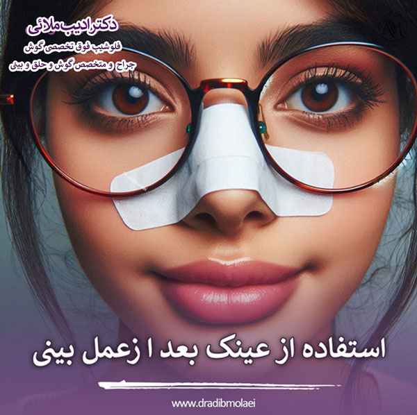 عینک زدن بعد از عمل بینی - دکتر ملائی