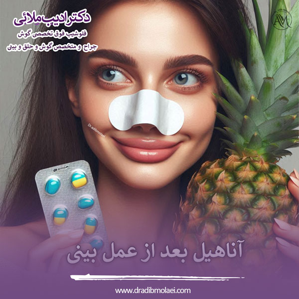 قرص آناهیل بعد از عمل بینی - دکتر ملایی
