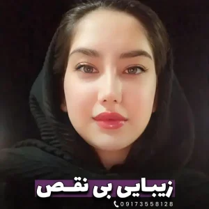 نمونه کار جراحی بینی گوشتی در شیراز توسط دکتر ادیب ملائی