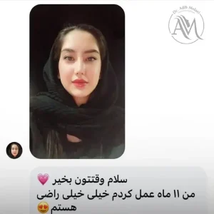 عمل بینی گوشتی در شیراز _ دکتر ادیب ملائی