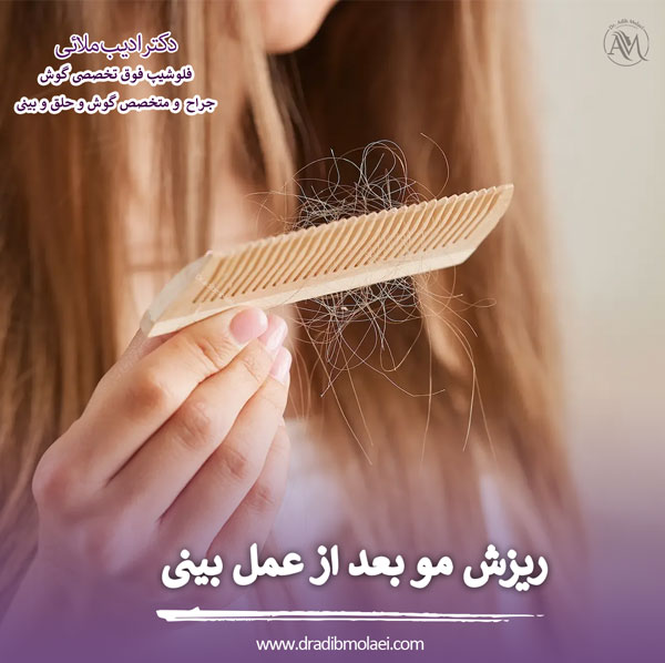 ریزش مو بعد از عمل بینی _ دکتر ادیب ملائی