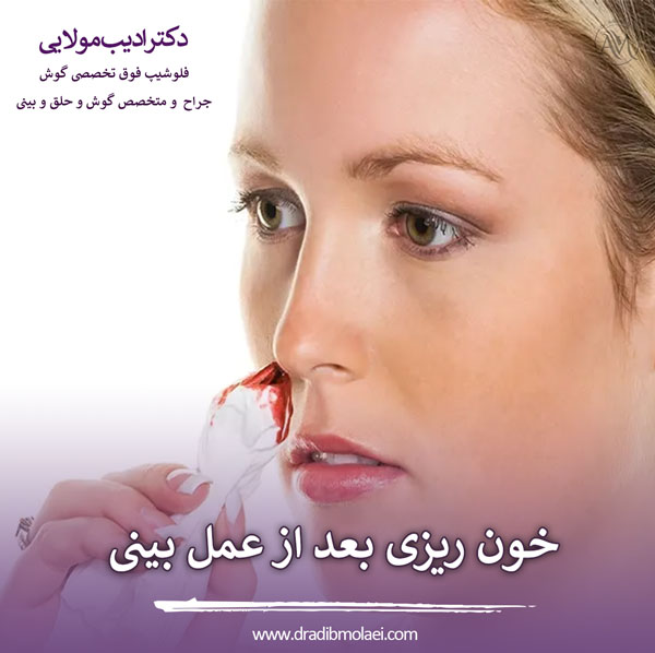خون ریزی بعد از جراحی بینی _ دکتر ادیب ملائی