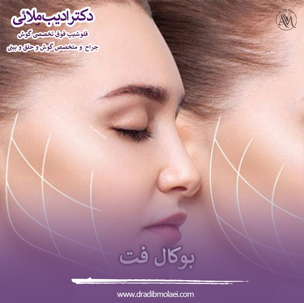 بوکال فت - دکتر ملایی