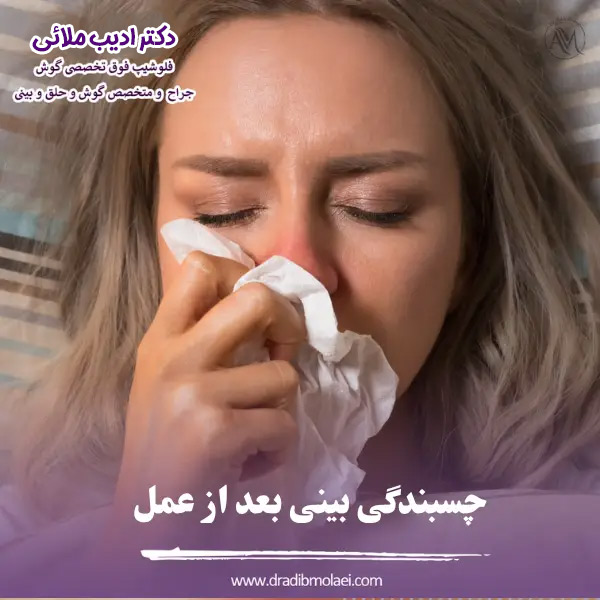 چسبندگی بینی بعد از عمل - دکتر ادیب ملائی
