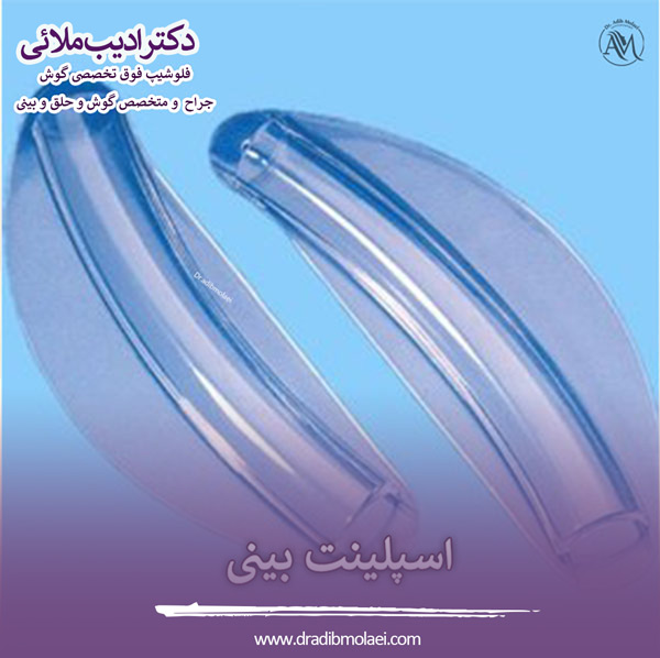 اسپلینت بینی - دکتر ملائی