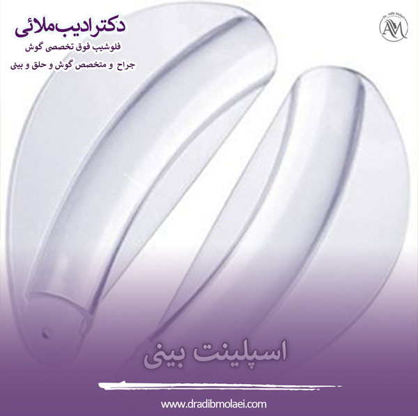اسپلینت بینی - دکتر ملائی