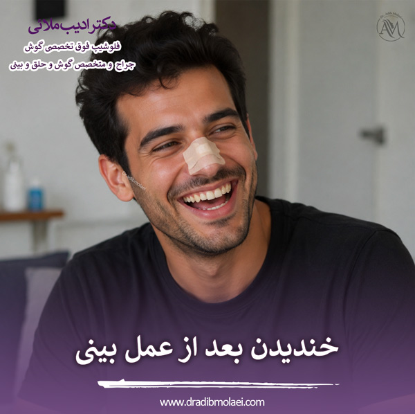 خندیدن بعد از عمل بینی - دکتر ادیب ملائی